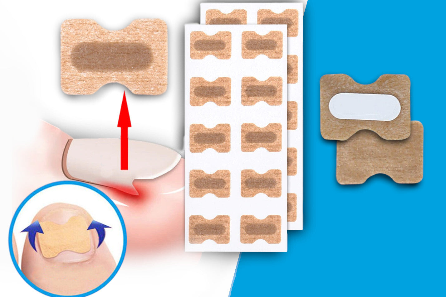 Flasteri za Urasle Nokte