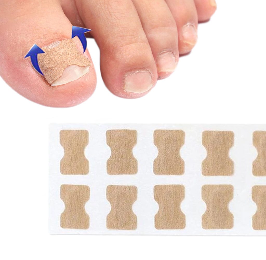 Flasteri za Urasle Nokte